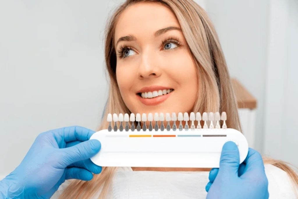 dental veneers in lake bonavista calgary