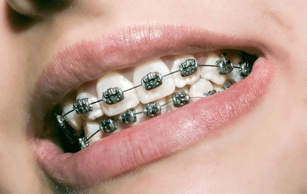 orthodontics near you