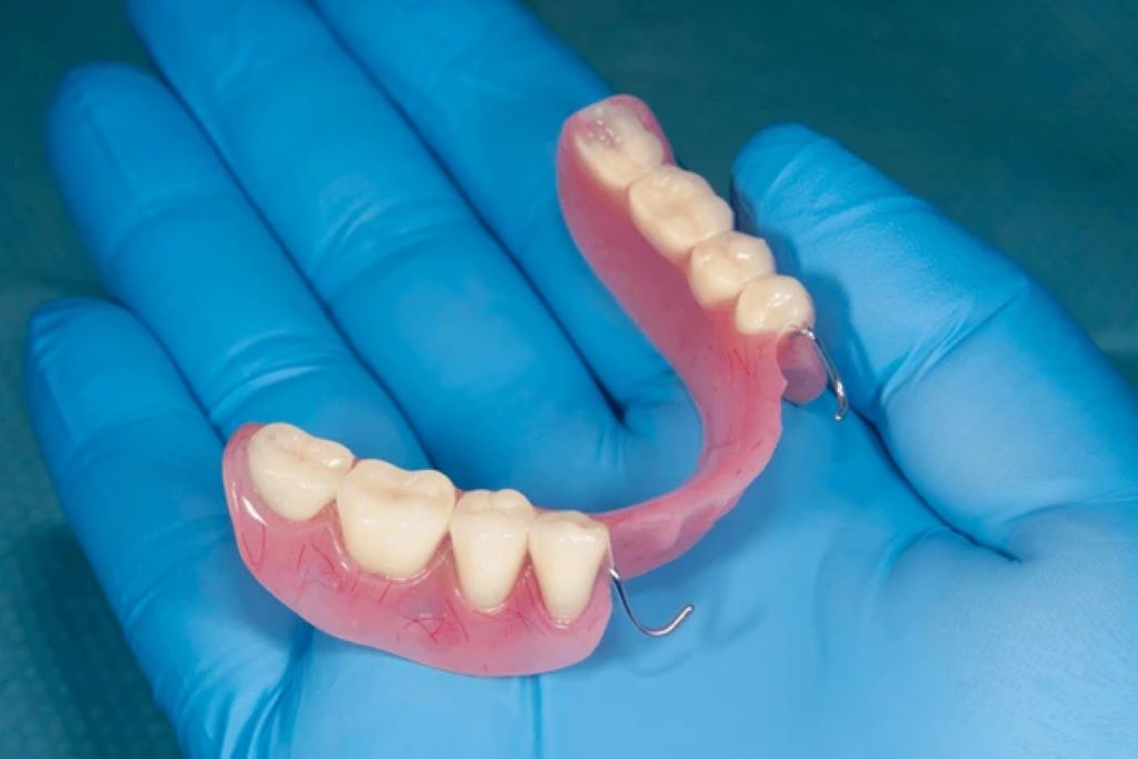 partial dentures in lake bonavista calgary