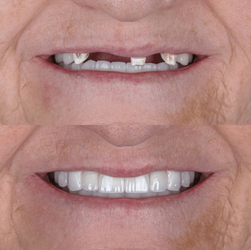restorative dentistry near you