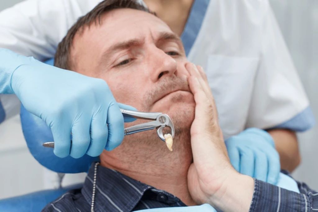 tooth extractions near you