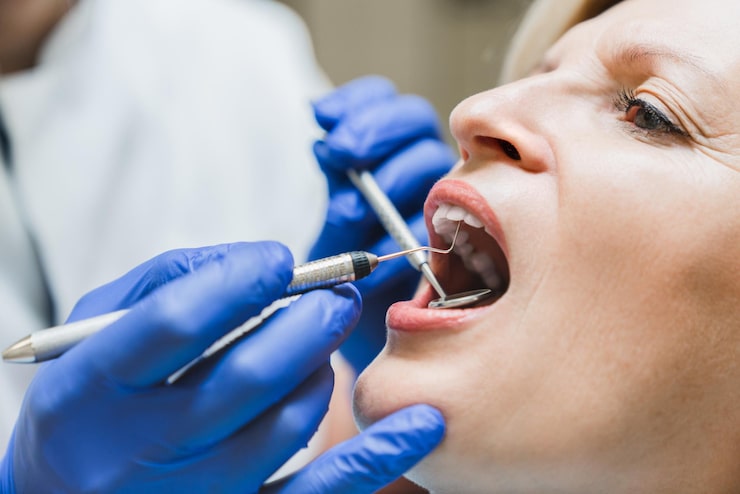 What are the signs you may need a dental filling